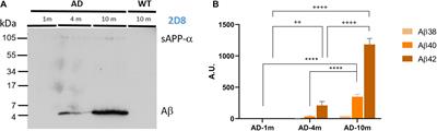 Analysis of Age-Dependent Alterations in Excitability Properties of CA1 Pyramidal Neurons in an APPPS1 Model of Alzheimer’s Disease